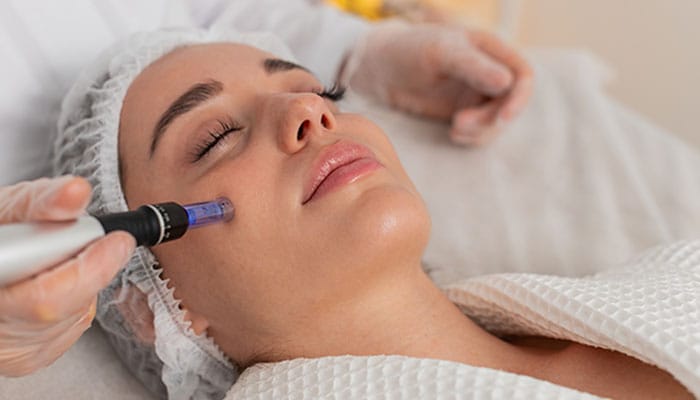 woman getting microneedling in Park Ridge, IL